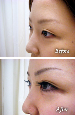 まつ毛エクステのbefore after